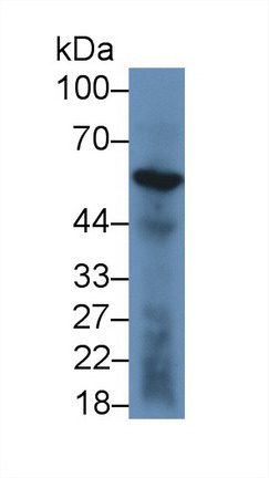 Polyclonal Antibody to Angiopoietin Like Protein 4 (ANGPTL4)