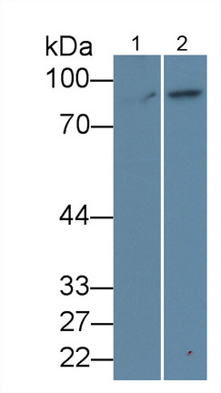 Polyclonal Antibody to Beta Catenin (β-catenin)