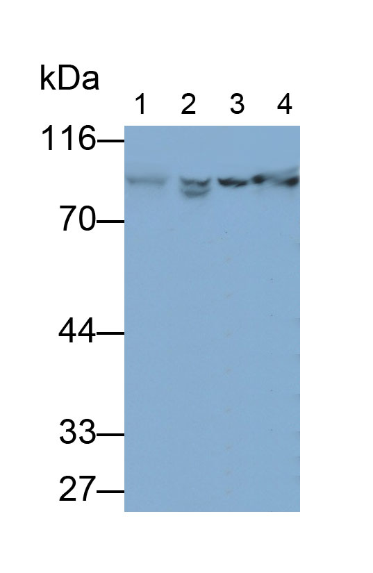 Polyclonal Antibody to Beta Catenin (β-catenin)