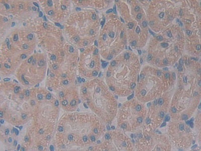 Polyclonal Antibody to Growth Hormone Receptor (GHR)