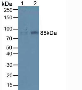 Polyclonal Antibody to Integrin Beta 1 (ITGb1)