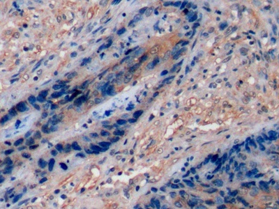 Polyclonal Antibody to Cluster Of Differentiation 15 (CD15)