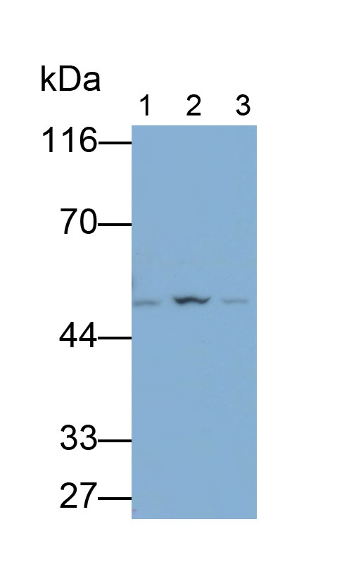 Polyclonal Antibody to Alkaline Phosphatase, Tissue-nonspecific (ALPL)