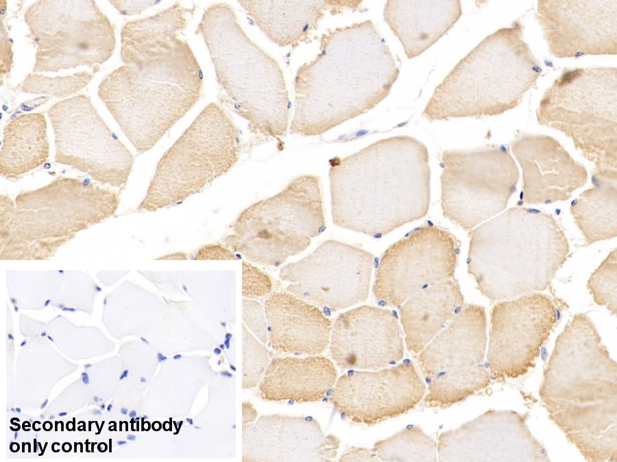 Polyclonal Antibody to Actinin Alpha 3 (ACTN3)