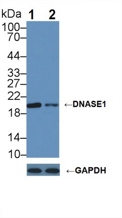 Polyclonal Antibody to Deoxyribonuclease I (DNASE1)