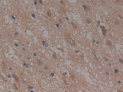 Polyclonal Antibody to Nucleoporin 155 (NUP155)