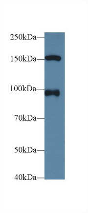 Polyclonal Antibody to Nucleoporin 98 (NUP98)