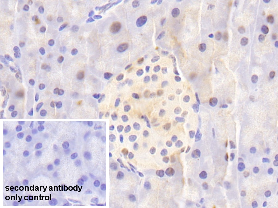 Polyclonal Antibody to Nucleoporin 88 (NUP88)