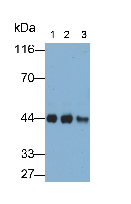 Polyclonal Antibody to Aspartate Aminotransferase (AST)