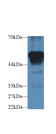 Polyclonal Antibody to Fibrinogen Beta Chain (FGB)