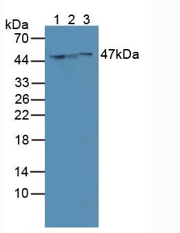 Polyclonal Antibody to Cytokeratin 18 (CK18)