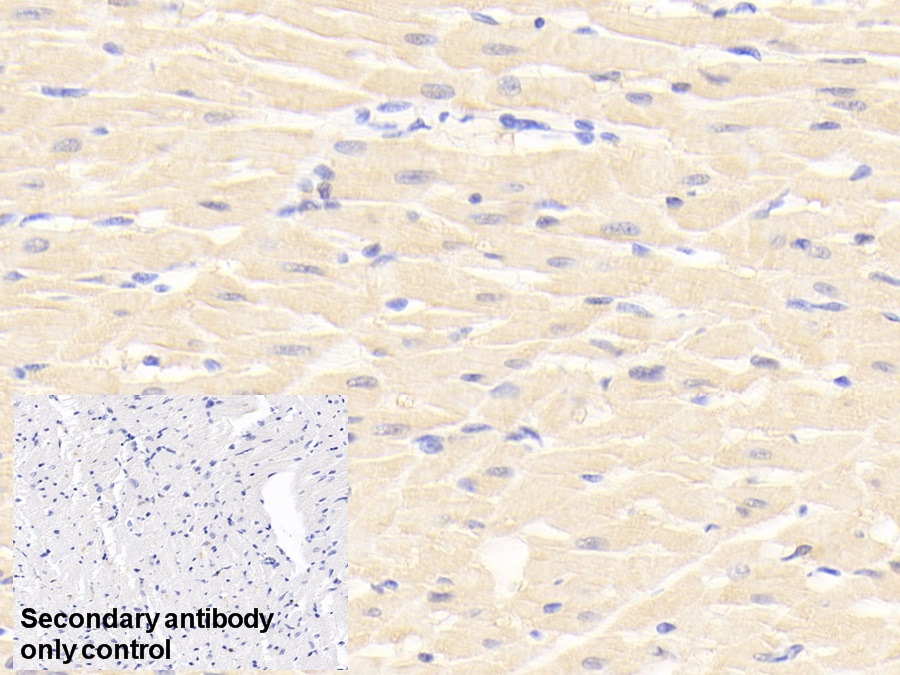 Polyclonal Antibody to Heart-type Fatty Acid Binding Protein (H-FABP)