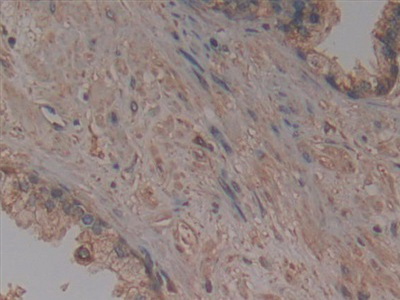 Polyclonal Antibody to Prolylcarboxypeptidase (PRCP)