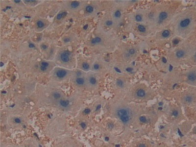 Polyclonal Antibody to Prolylcarboxypeptidase (PRCP)