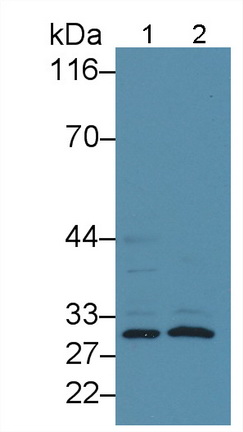 Polyclonal Antibody to Fc Fragment Of IgG Low Affinity IIIa Receptor (FcgR3A)