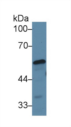 Polyclonal Antibody to Adrenergic Receptor Alpha 1A (ADRa1A)