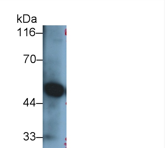 Polyclonal Antibody to Adrenergic Receptor Alpha 1A (ADRa1A)