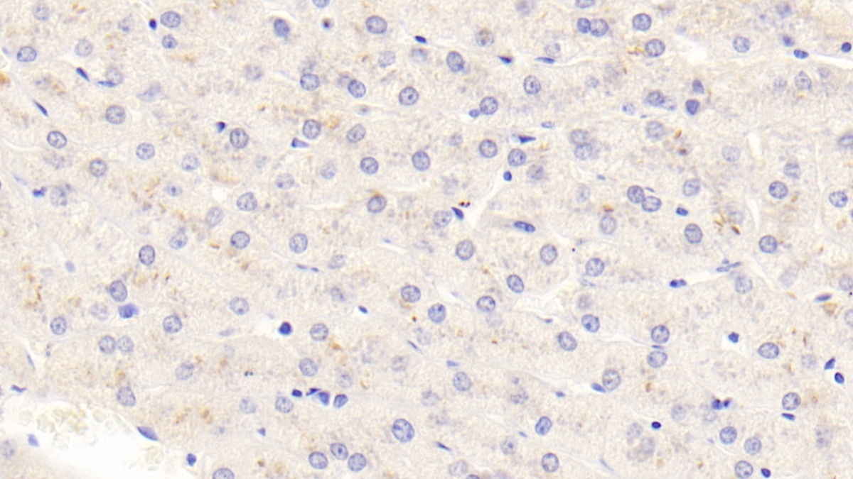 Polyclonal Antibody to Thymic Stromal Lymphopoietin (TSLP)