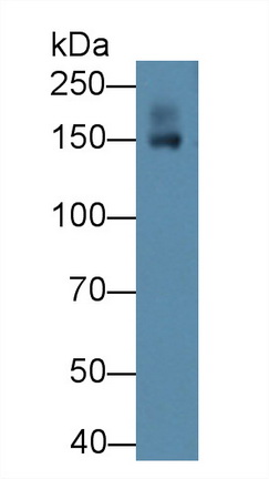 Polyclonal Antibody to Tenascin R (TNR)