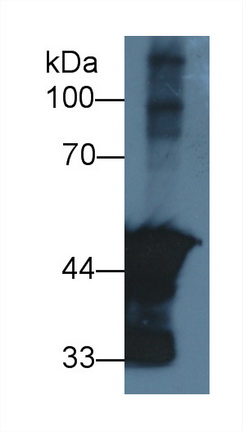 Polyclonal Antibody to Actin Alpha 2, Smooth Muscle (ACTa2)