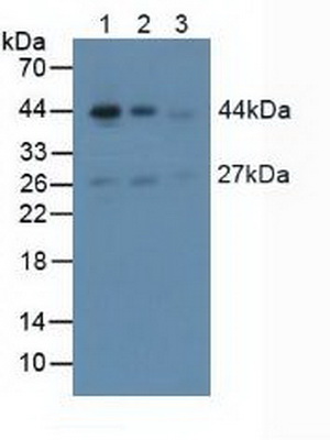 Polyclonal Antibody to Actin Alpha 2, Smooth Muscle (ACTa2)