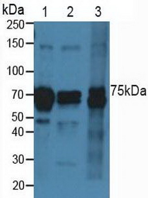 Polyclonal Antibody to Cadherin 5 (CDH5)