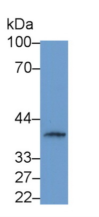Polyclonal Antibody to Gamma-Glutamyltransferase 1 (gGT1)