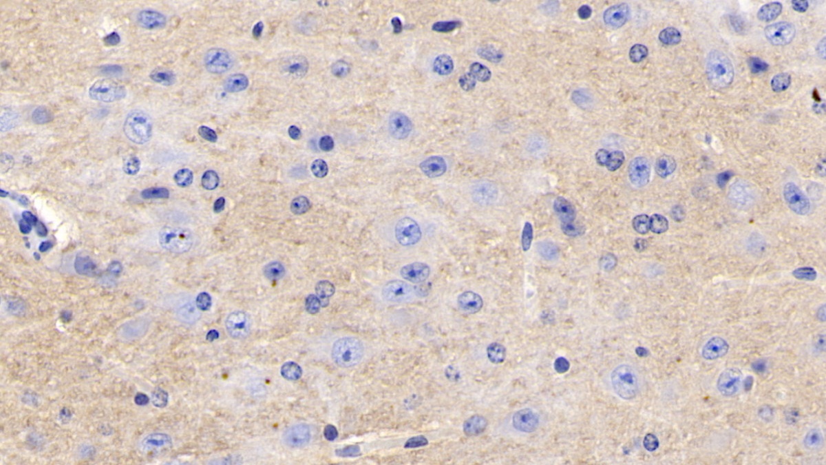 Polyclonal Antibody to Cluster of Differentiation 90 (CD90)