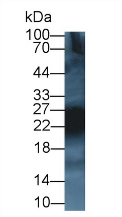 Polyclonal Antibody to Cluster Of Differentiation 99 (CD99)