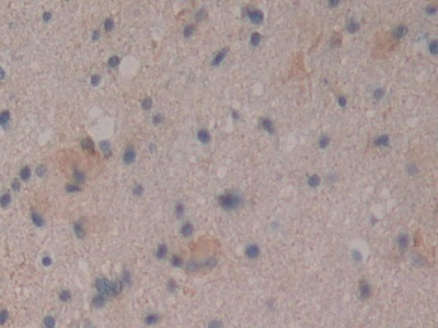 Polyclonal Antibody to Cluster Of Differentiation 109 (CD109)