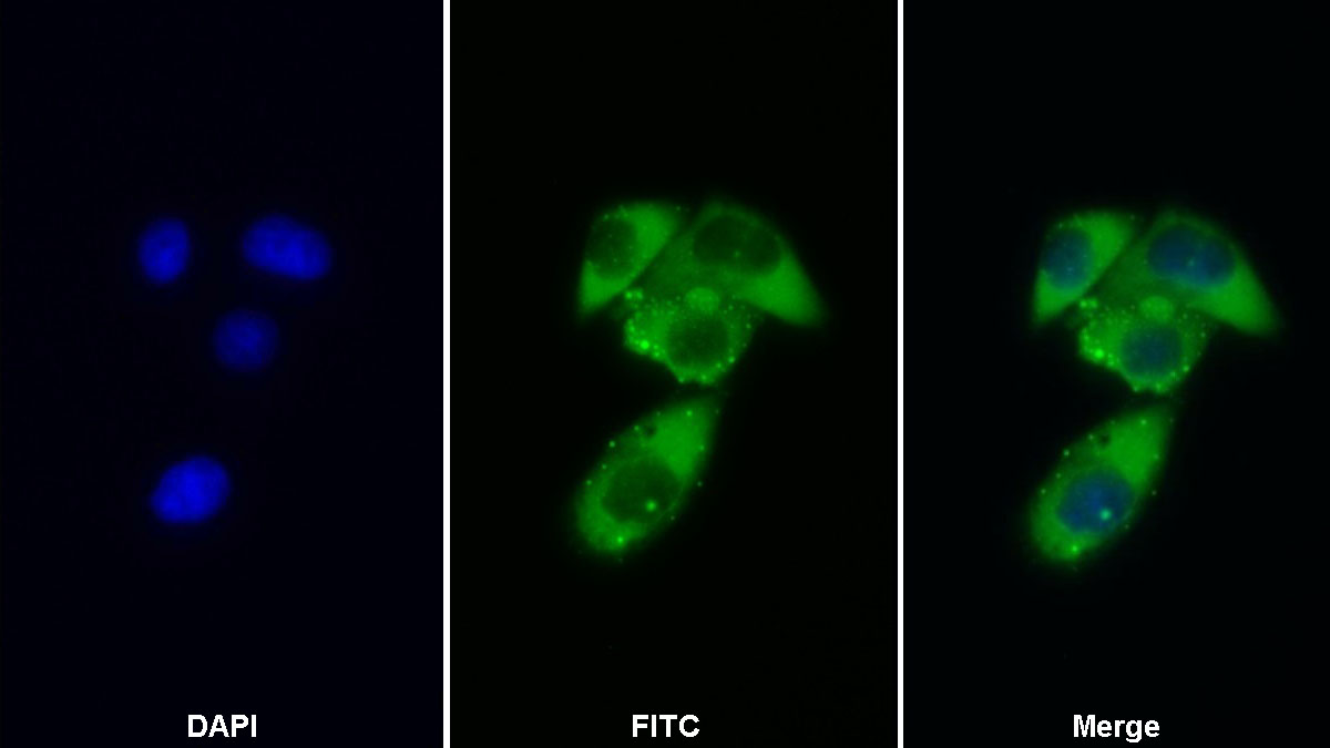 Polyclonal Antibody to Colony Stimulating Factor Receptor, Granulocyte (GCSFR)