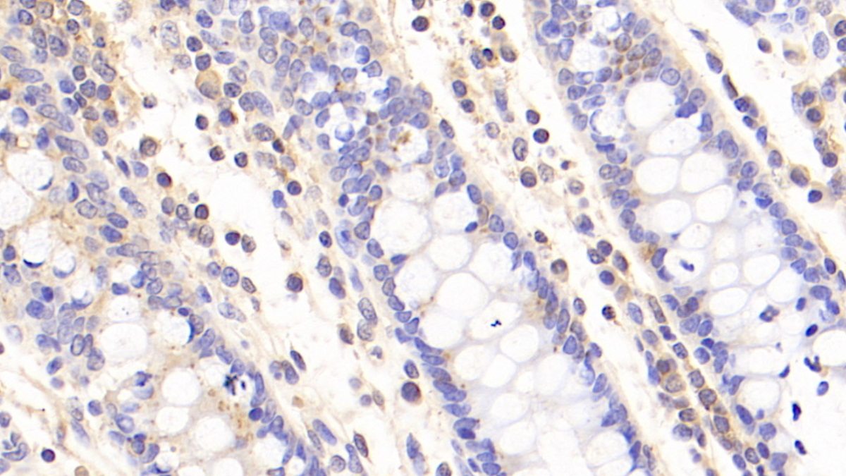 Polyclonal Antibody to Colony Stimulating Factor Receptor, Macrophage (MCSFR)