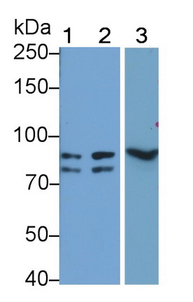 Polyclonal Antibody to Interferon Gamma Receptor 1 (IFNgR1)