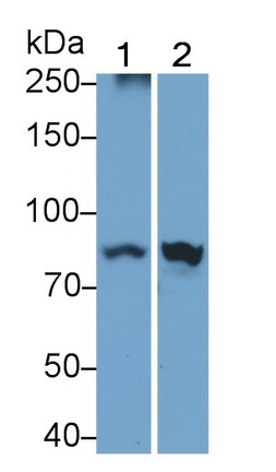Polyclonal Antibody to Interferon Gamma Receptor 1 (IFNgR1)