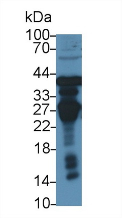 Polyclonal Antibody to Ornithine Transcarbamylase (OTC)