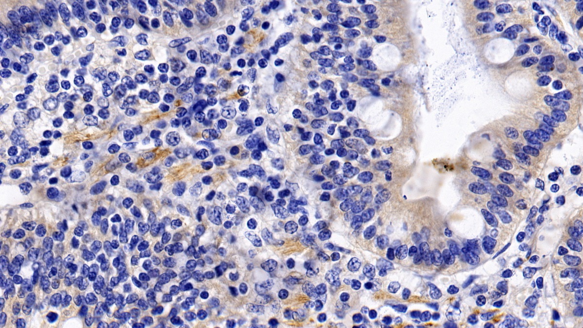 Polyclonal Antibody to Tumor Necrosis Factor Receptor 1 (TNFR1)