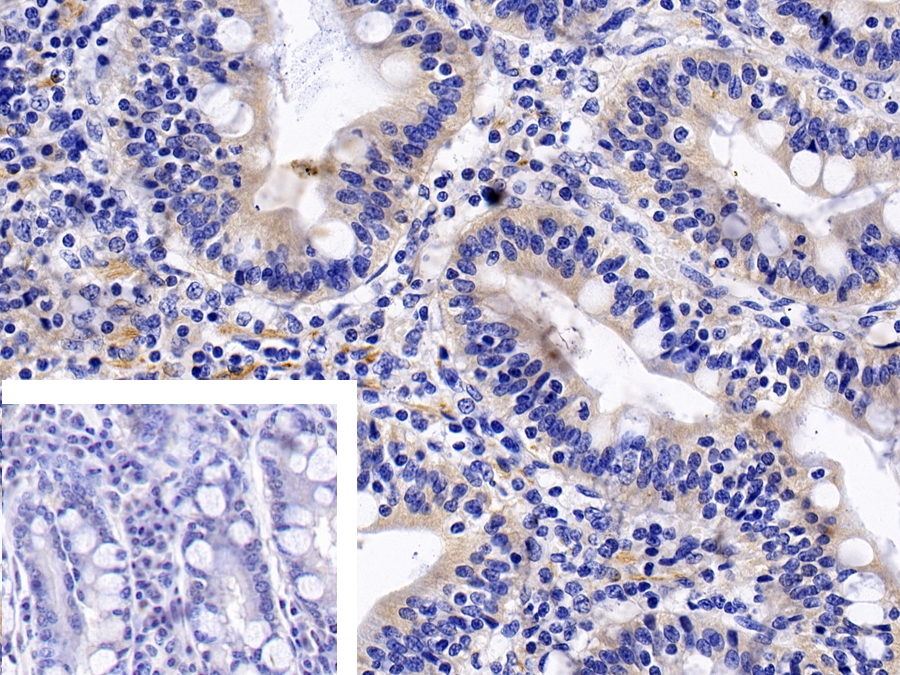 Polyclonal Antibody to Tumor Necrosis Factor Receptor 1 (TNFR1)