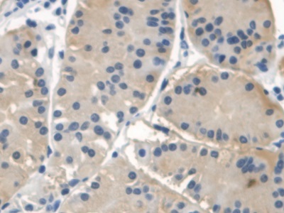 Polyclonal Antibody to Neuronal Apoptosis Inhibitory Protein (NAIP)