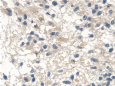 Polyclonal Antibody to Neuronal Apoptosis Inhibitory Protein (NAIP)