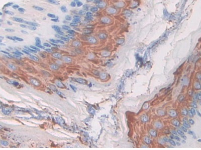 Polyclonal Antibody to Macrophage Stimulating 1 Receptor (MST1R)