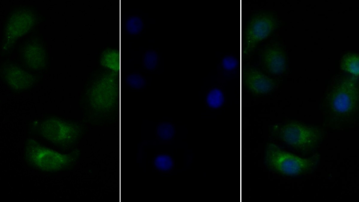 Polyclonal Antibody to Colony Stimulating Factor 2 Receptor Beta (CSF2Rb)