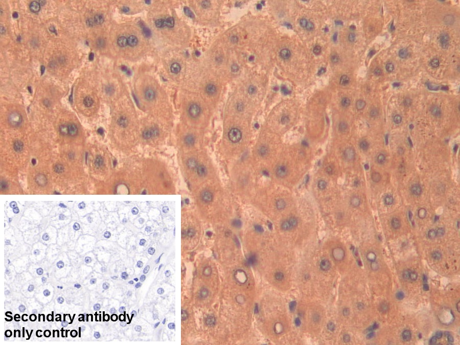 Polyclonal Antibody to Gamma-cystathionase (CTH)