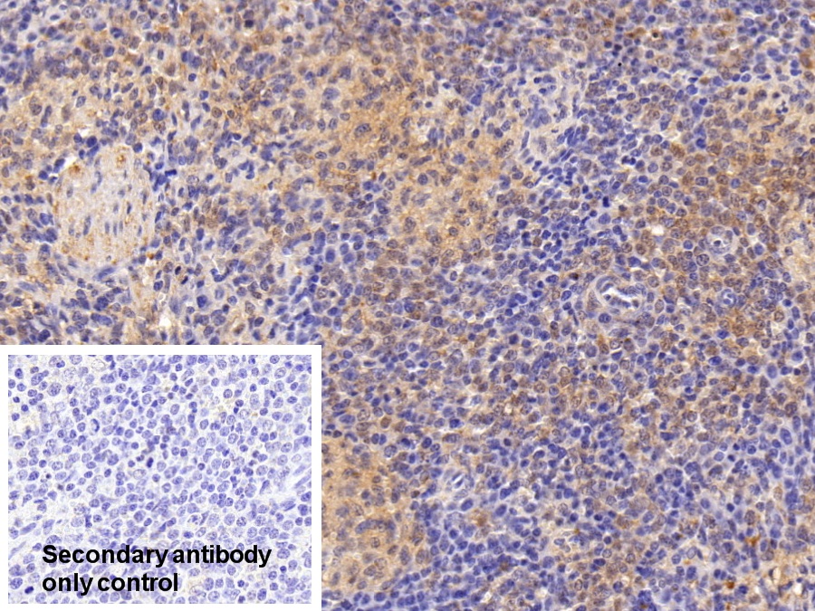 Polyclonal Antibody to Serum Amyloid P Component (SAP)