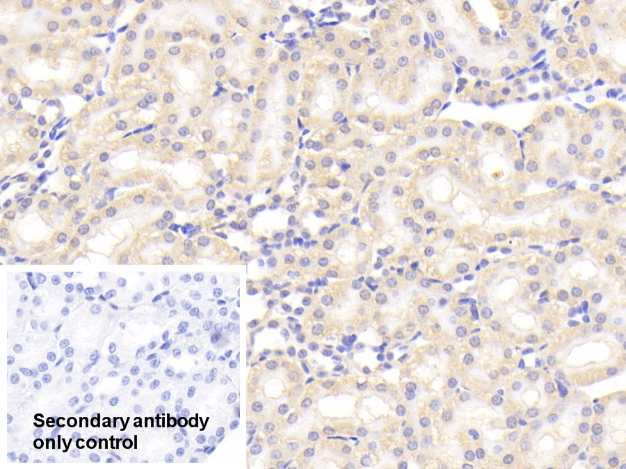 Polyclonal Antibody to Serum Amyloid P Component (SAP)