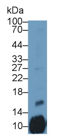 Polyclonal Antibody to Platelet Factor 4 Variant 1 (PF4V1)