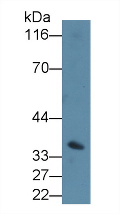 Polyclonal Antibody to Cluster Of Differentiation 64 (CD64)