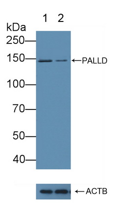 Polyclonal Antibody to Palladin (PALLD)