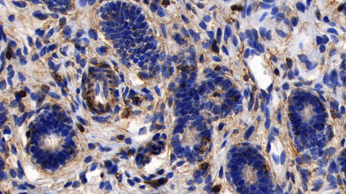 Polyclonal Antibody to Macrophage Scavenger Receptor 1 (MSR1)