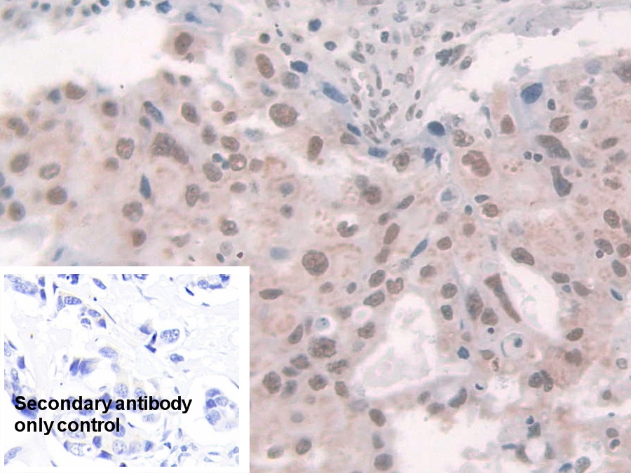 Polyclonal Antibody to Glucocorticoid Receptor (GR)