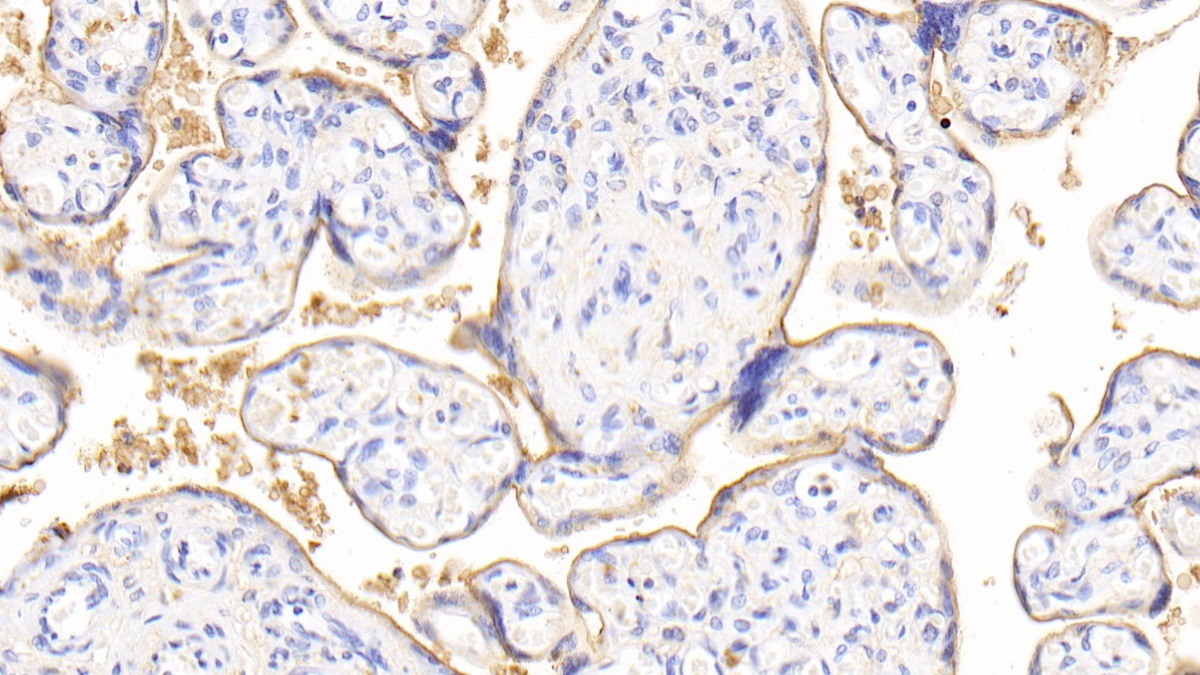 Polyclonal Antibody to Neuraminidase (NEU)